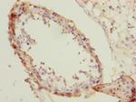 NMT2 Antibody in Immunohistochemistry (Paraffin) (IHC (P))