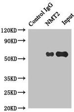 NMT2 Antibody in Western Blot (WB)