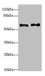 NMT2 Antibody in Western Blot (WB)