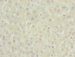 NNMT Antibody in Immunohistochemistry (Paraffin) (IHC (P))