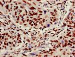 Ku70 Antibody in Immunohistochemistry (Paraffin) (IHC (P))