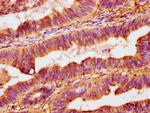 OMD Antibody in Immunohistochemistry (Paraffin) (IHC (P))