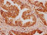 OMD Antibody in Immunohistochemistry (Paraffin) (IHC (P))