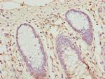 OPHN1 Antibody in Immunohistochemistry (Paraffin) (IHC (P))