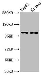 PCSK5 Antibody in Western Blot (WB)