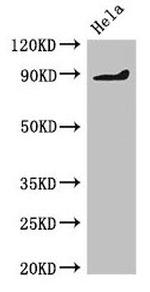 PDE2A Antibody in Western Blot (WB)