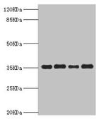 PDXK Antibody in Western Blot (WB)