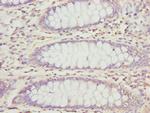 PECR Antibody in Immunohistochemistry (Paraffin) (IHC (P))