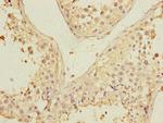 PGAM2 Antibody in Immunohistochemistry (Paraffin) (IHC (P))