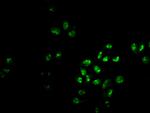 PHF6 Antibody in Immunocytochemistry (ICC/IF)