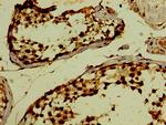 PHF6 Antibody in Immunohistochemistry (Paraffin) (IHC (P))