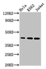 PHF6 Antibody in Western Blot (WB)