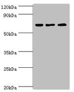 PIAS2 Antibody in Western Blot (WB)