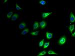 PPAP2C Antibody in Immunocytochemistry (ICC/IF)