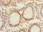 PPAP2C Antibody in Immunohistochemistry (Paraffin) (IHC (P))