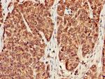 PP1 beta Antibody in Immunohistochemistry (Paraffin) (IHC (P))