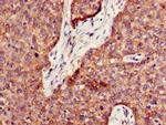 PPT1 Antibody in Immunohistochemistry (Paraffin) (IHC (P))