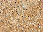 PRKAR2A Antibody in Immunohistochemistry (Paraffin) (IHC (P))