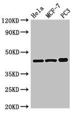 PRKAR2A Antibody in Western Blot (WB)