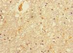 PRMT3 Antibody in Immunohistochemistry (Paraffin) (IHC (P))