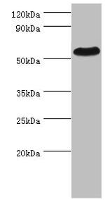 Presenilin 1 Antibody in Western Blot (WB)