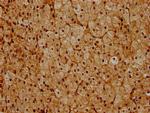 PSMC6 Antibody in Immunohistochemistry (Paraffin) (IHC (P))