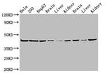 PSMC6 Antibody in Western Blot (WB)