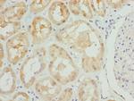 PSPH Antibody in Immunohistochemistry (Paraffin) (IHC (P))