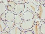 PSPH Antibody in Immunohistochemistry (Paraffin) (IHC (P))