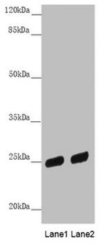 PSPH Antibody in Western Blot (WB)