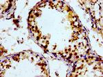 PTGR2 Antibody in Immunohistochemistry (Paraffin) (IHC (P))