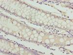 RAB3B Antibody in Immunohistochemistry (Paraffin) (IHC (P))