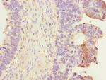 RALB Antibody in Immunohistochemistry (Paraffin) (IHC (P))