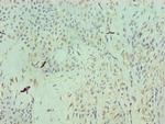 RAN Antibody in Immunohistochemistry (Paraffin) (IHC (P))