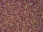 RECQ4 Antibody in Immunohistochemistry (Paraffin) (IHC (P))