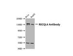 RECQ4 Antibody in Western Blot (WB)