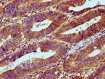 RNaseH1 Antibody in Immunohistochemistry (Paraffin) (IHC (P))