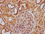 RNaseH1 Antibody in Immunohistochemistry (Paraffin) (IHC (P))