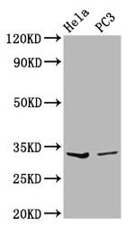 RNaseH1 Antibody in Western Blot (WB)