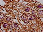 RPL7A Antibody in Immunohistochemistry (Paraffin) (IHC (P))