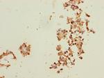 Ribophorin II Antibody in Immunohistochemistry (Paraffin) (IHC (P))