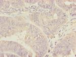 Ribophorin II Antibody in Immunohistochemistry (Paraffin) (IHC (P))