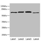 Ribophorin II Antibody in Western Blot (WB)