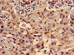 RPS15 Antibody in Immunohistochemistry (Paraffin) (IHC (P))