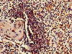 RPS15 Antibody in Immunohistochemistry (Paraffin) (IHC (P))