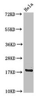 RPS15 Antibody in Western Blot (WB)