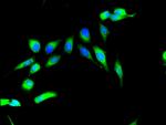 MSK2 Antibody in Immunocytochemistry (ICC/IF)