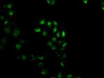 Gemin 2 Antibody in Immunocytochemistry (ICC/IF)