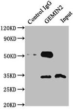 Gemin 2 Antibody in Western Blot (WB)