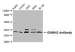 Gemin 2 Antibody in Western Blot (WB)